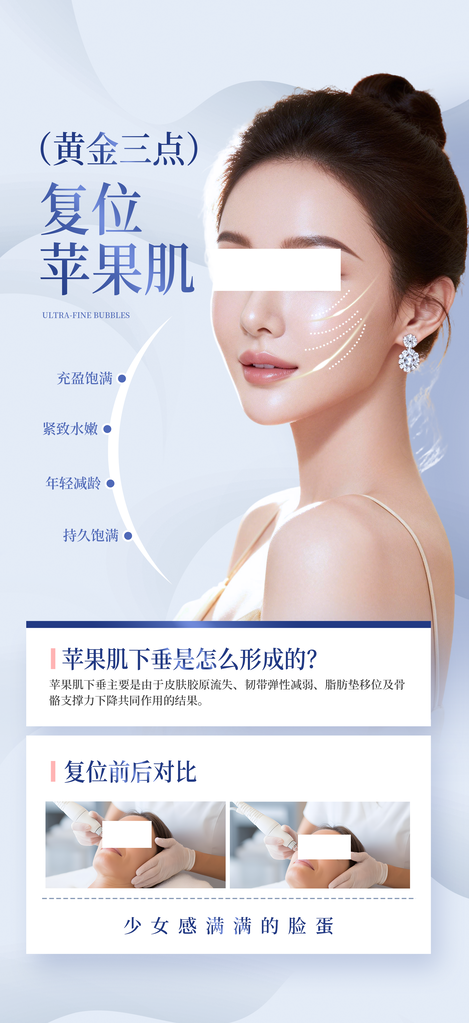 微整形苹果肌提升复位医美海报