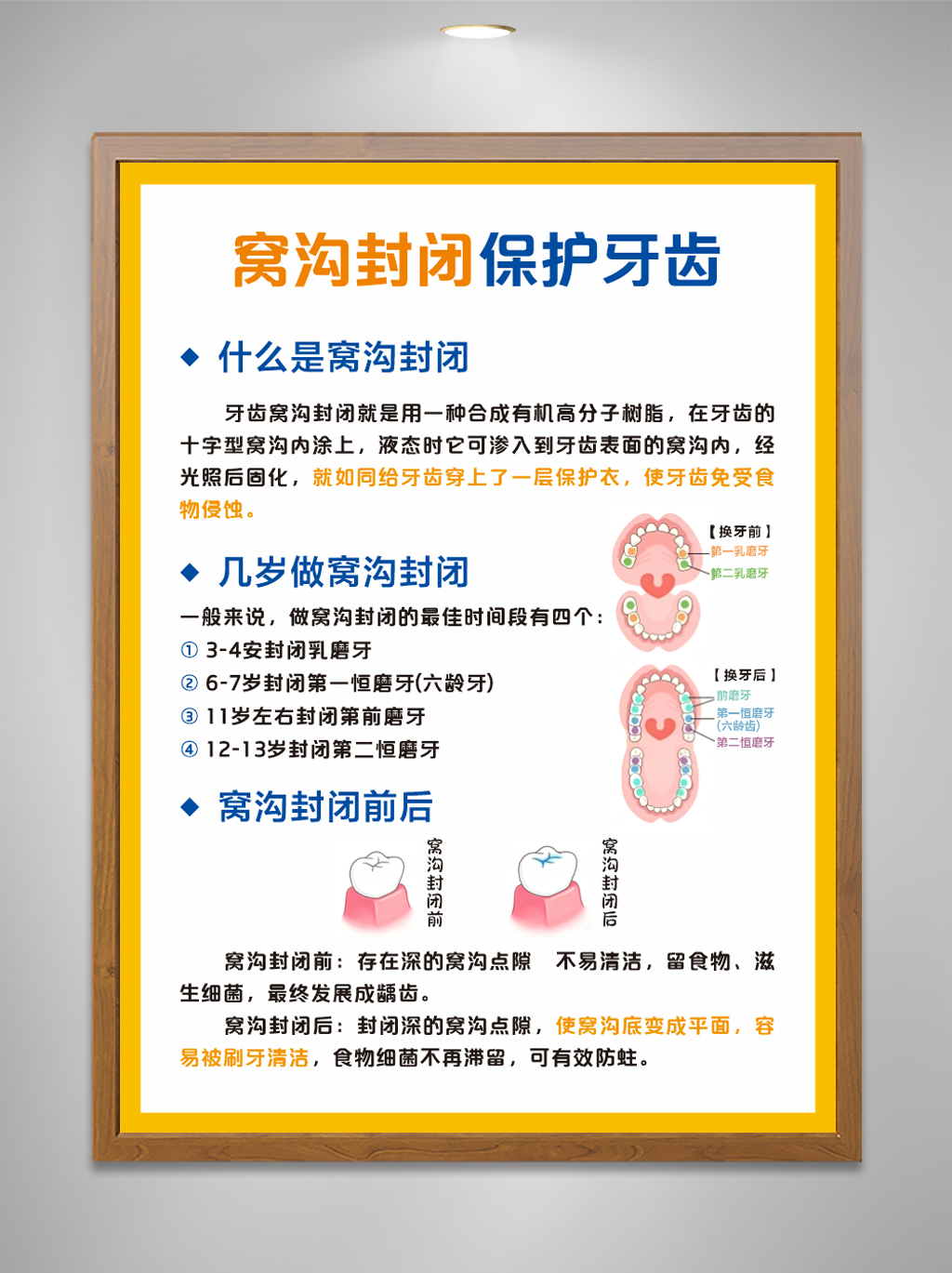 窝沟封闭保护牙齿口腔医院牙科海报